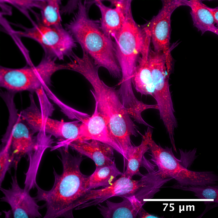 Bright pink cell structures with glowing blue nuclei and yellow/orange nanoparticles visible because of their fluorescence. Scale bar = 75 microns